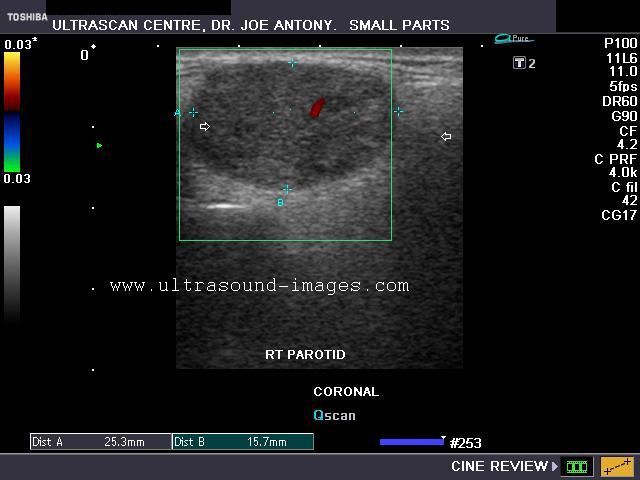 A Gallery of High-Resolution, Ultrasound, Color Doppler & 3D Images ...