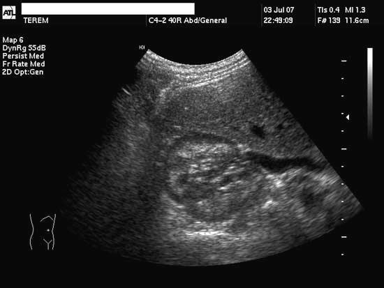 A Gallery of High-Resolution, Ultrasound, Color Doppler & 3D Images ...