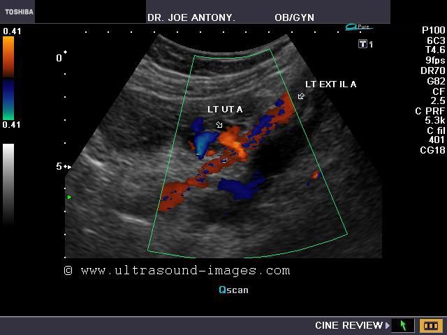 Ultrasound Images Of Fetal General